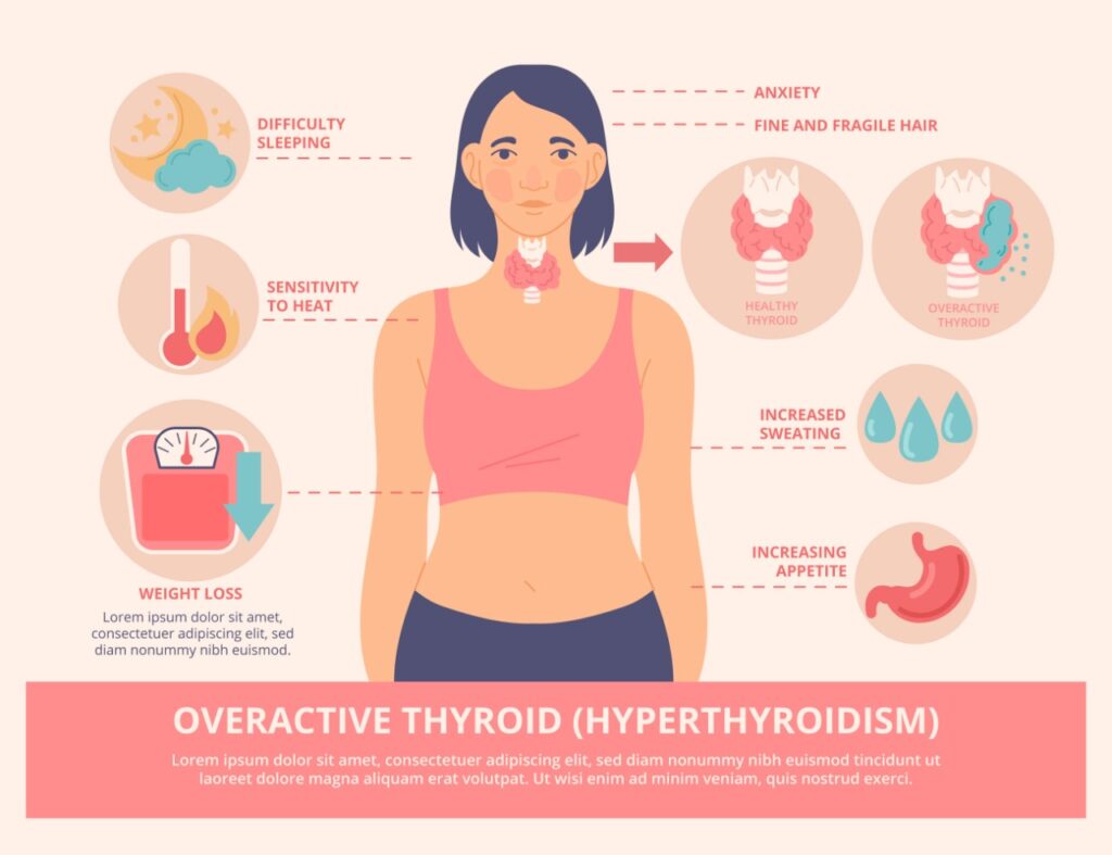 hyperthyroidism